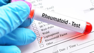 Rheumatoid Factor (RF) Blood Test