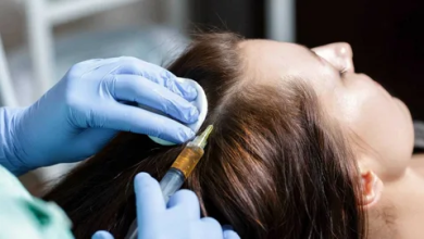 hair loss treatment in noida
